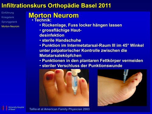 Gesundspritzen?! Gelenksinfiltration am anatomischen Präparat