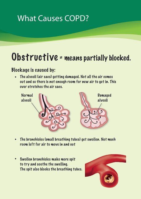 Chronic Obstructive Pulmonary Disease COPD - Queensland Health