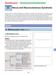 20 Nevus and Neurocutaneous Syndrome