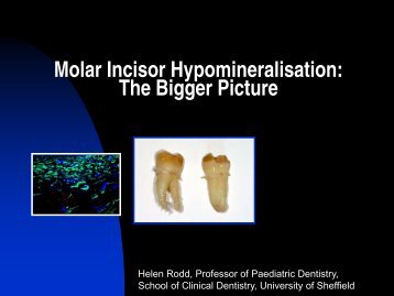 Molar Incisor Hypomineralisation: The Bigger Picture