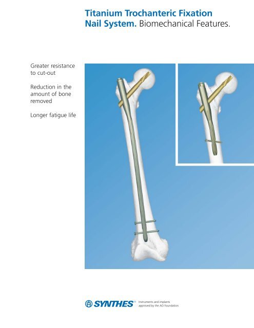 TFN-ADVANCED™ Proximal Femoral Nailing System | DePuy Synthes | J&J MedTech  US