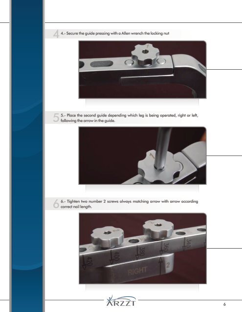 Surgical Technique for Femur Nail - ARZZT