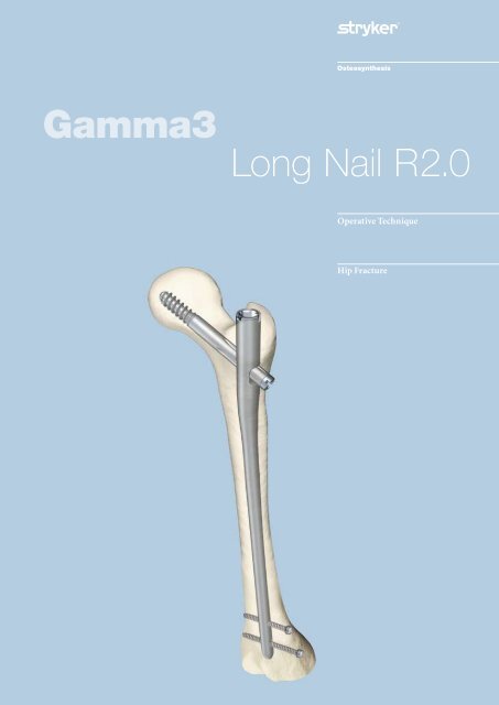 Gamma3 Long Nail R2.0 Operative Technique - Stryker