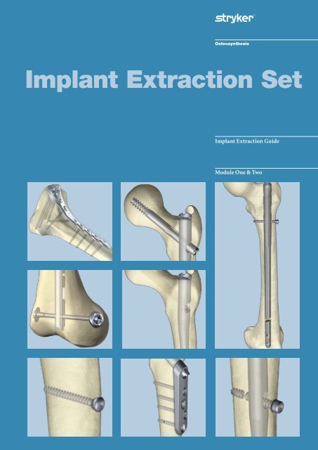 Implant Extraction Set - Stryker