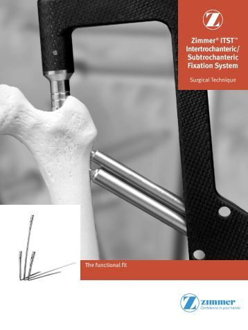 osteosynthesis stryker recon nail The t2 recon nail is the latest development for the treatment of proximal hip and diaphyseal femoral fractures. osteosynthesis stryker recon nail The t2 recon nail is the latest development for the treatment of proximal hip and diaphyseal femoral fractures.