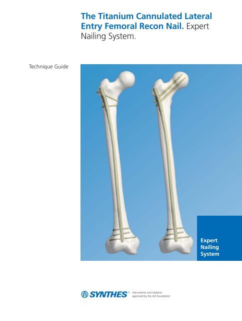 Intramedullary Femoral (IM) Nailing | Mahe Medical USA | Manufacturer of  Orthopedic Medical Devices