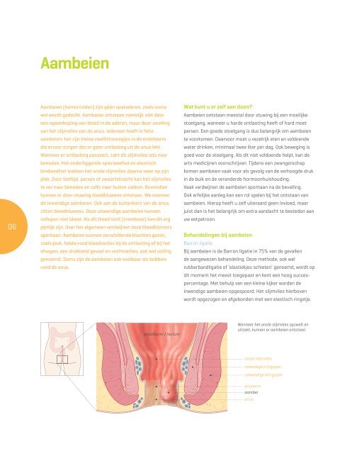 Proctologie - Helder kliniek