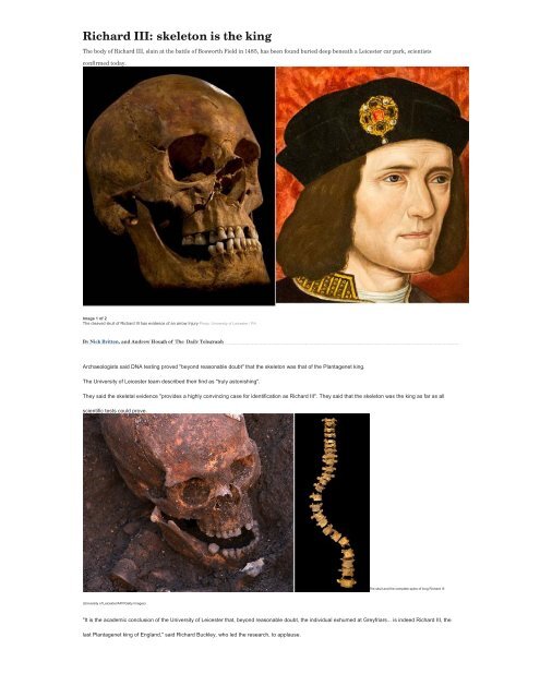 Richard III: skeleton is the king - Gainsborough Old Hall