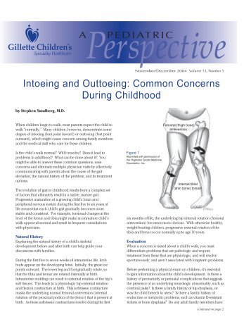 Intoeing and Outtoeing: Common Concerns During Childhood