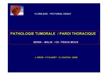 PAROI THORACIQUE J GIRON - Club Thorax