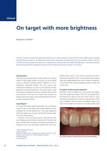On target with more brightness - International Dentistry SA - Modern ...