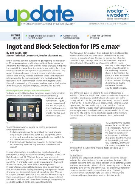 Emax Ingot Selection Chart