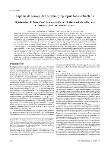 Lipoma de convexidad cerebral y epilepsia focal refractaria