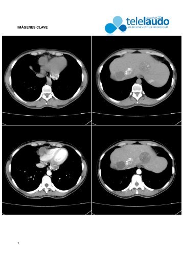 tc abdomen-pelvis - Telelaudo