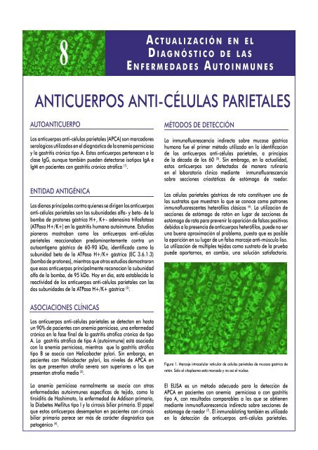 qué significa anticuerpos anti helicobacter pylori igg positivo