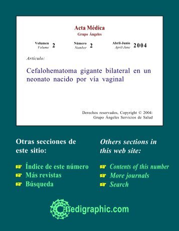 Cefalohematoma gigante bilateral en un neonato ... - edigraphic.com