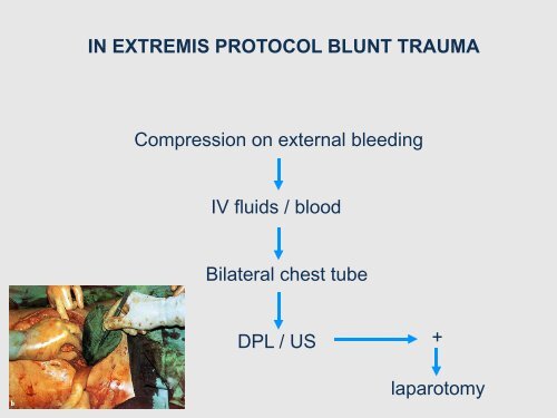 OPVANG EN BEHANDELING BIJ TRAUMA - Belsurg