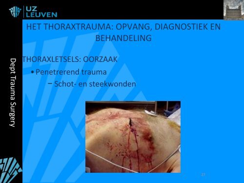 OPVANG EN BEHANDELING BIJ TRAUMA - Belsurg