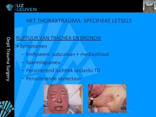 OPVANG EN BEHANDELING BIJ TRAUMA - Belsurg