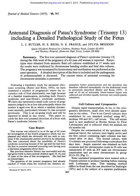 Antenatal Diagnosis of Patau's Syndrome (Trisomy 13) including a ...