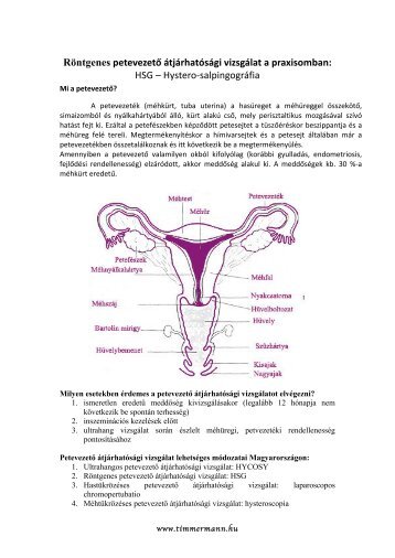 Röntgenes petevezető átjárhatósági vizsgálat a praxisomban: HSG ...