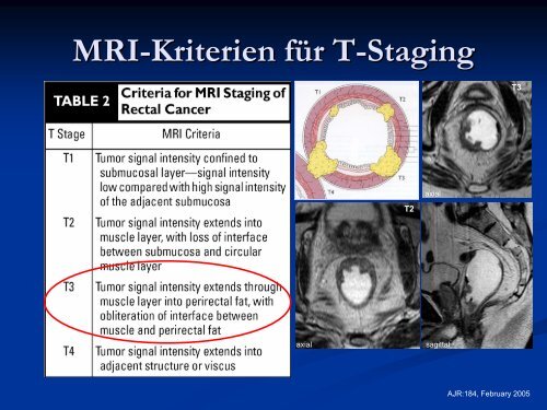 MRI-Staging des Rektumkarzinoms.pdf