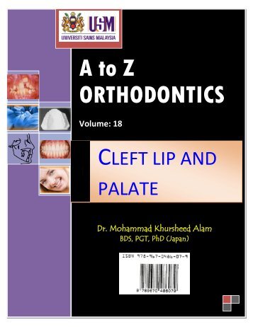 A to Z Orthodontics Vol 18 Cleft lip and palate - Dr. Mohammad ...