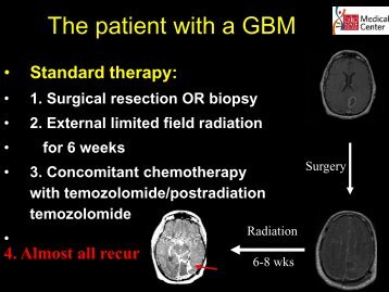 A Phase I Study of the Treatment of Recurrent Malignant Glioma with ...