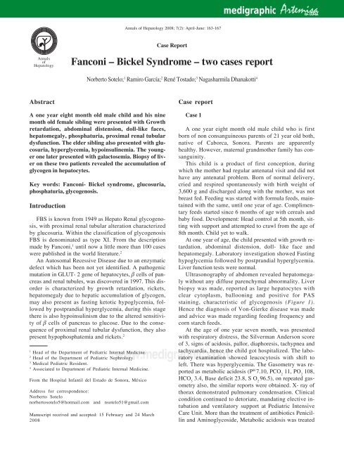 Fanconi â€“ Bickel Syndrome â€“ two cases report - edigraphic.com