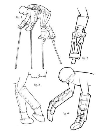 On the Design of Foreleg Extensions and Quadrupedal - The Art and ...