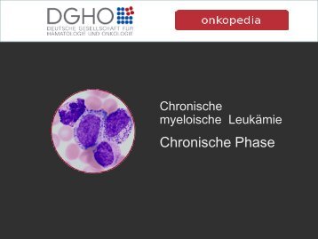 Chronische Phase - Onkopedia