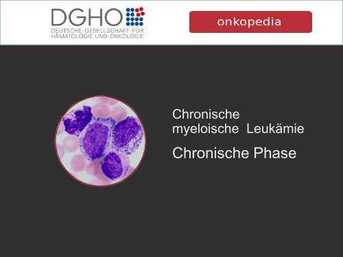 Chronische Phase - Onkopedia