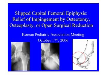 Slipped Capital Femoral Epiphysis: Relief of Impingement by ...