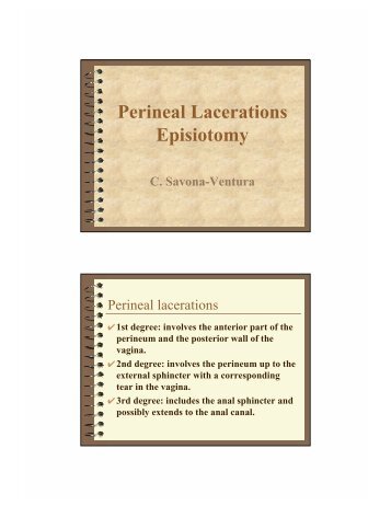 Perineal Lacerations Episiotomy