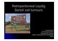 Retroperitoneal Leydig Sertoli cell tumours