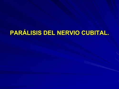 parálisis del nervio cubital.