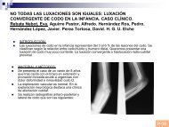 Traslocación radio-cubital proximal - Sotocav