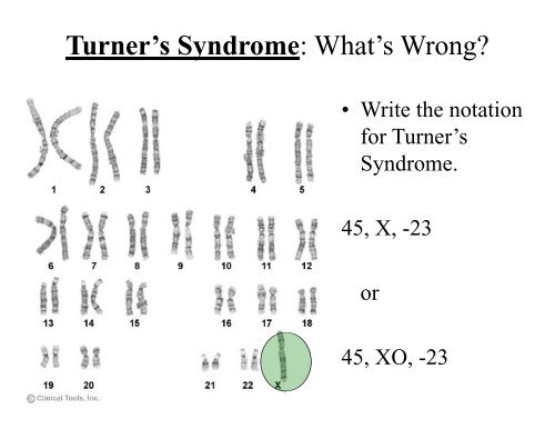 Chromosomes PowerPoint 2009-2010