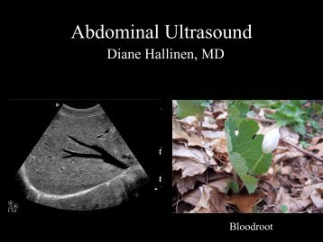 Abdominal Ultrasound - Livingston and Brighton ED