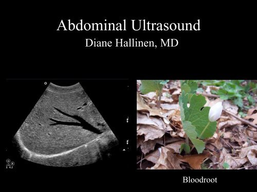 Abdominal Ultrasound - Livingston and Brighton ED