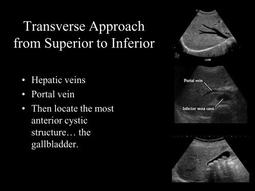 Abdominal Ultrasound - Livingston and Brighton ED