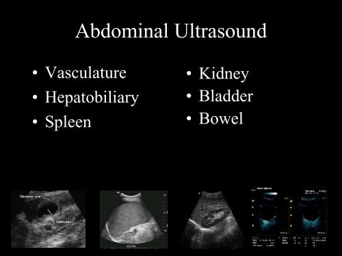 Abdominal Ultrasound - Livingston and Brighton ED