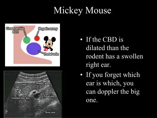 Abdominal Ultrasound - Livingston and Brighton ED