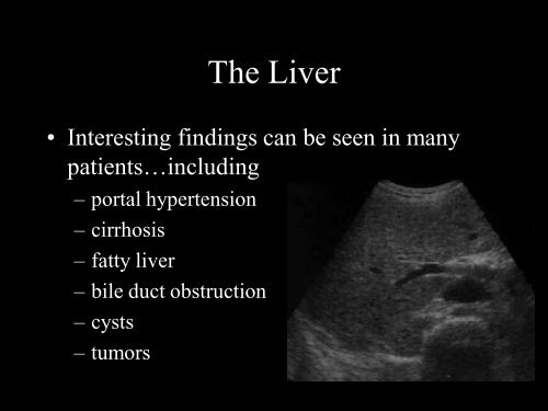 Abdominal Ultrasound - Livingston and Brighton ED