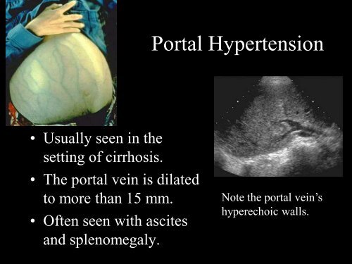 Abdominal Ultrasound - Livingston and Brighton ED