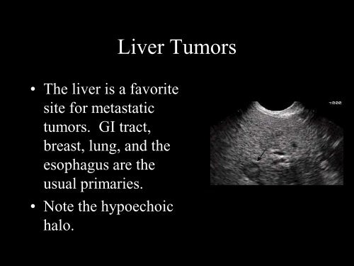 Abdominal Ultrasound - Livingston and Brighton ED