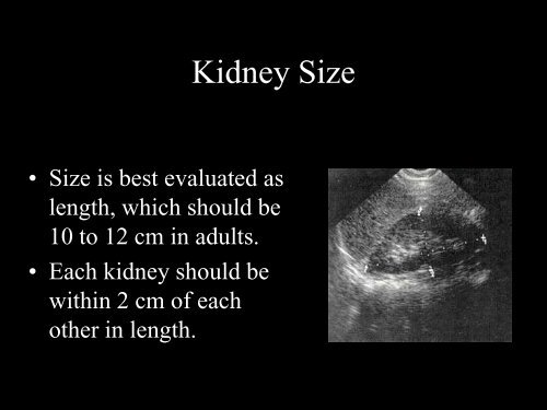 Abdominal Ultrasound - Livingston and Brighton ED