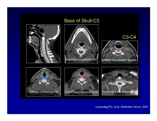 Basics of Head and Neck IMRT Planning and Anatomy - ASTRO