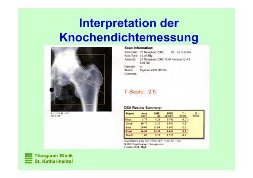 Osteoporose, State of the Art - Spital Thurgau AG