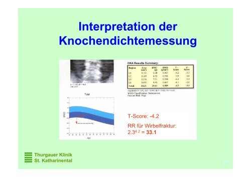 Osteoporose, State of the Art - Spital Thurgau AG